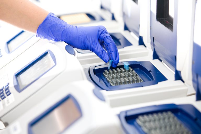 Which is the best in vitro diagnostic test method?