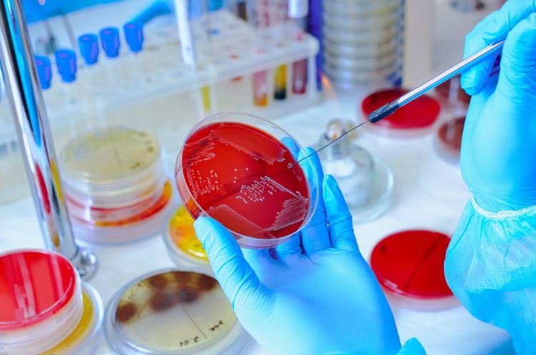 Why is microbiological testing in medical device manufacturing important?