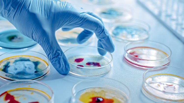 View From The Petri Dish: Current techniques used in the quality control of  culture media required for pharmaceutical microbiology