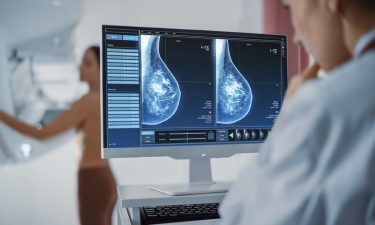 Kisqali Increases Overall Survival In Advanced Breast Cancer Patients ...