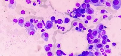 SARCLISA multiple myeloma