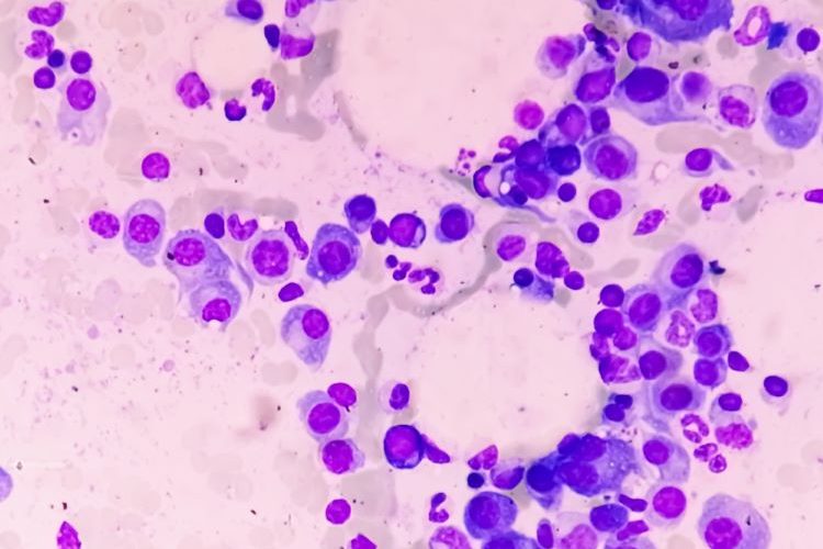 SARCLISA multiple myeloma