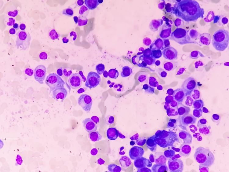 SARCLISA multiple myeloma