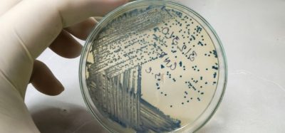 bacterial colonies characterisation