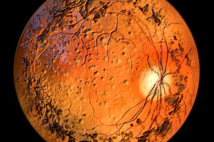 modifier gene therapy retinitis pigmentosa