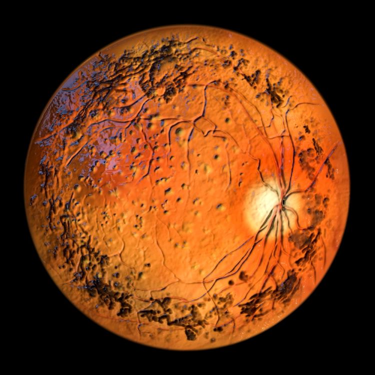 modifier gene therapy retinitis pigmentosa