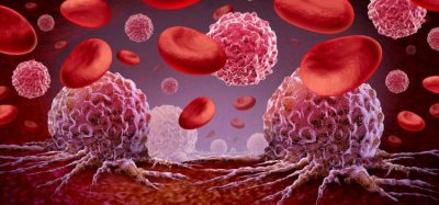 immunotherapy acute lymphoblastic leukaemia (ALL)