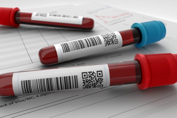 Blood test can identify COVID patients at high risk of severe