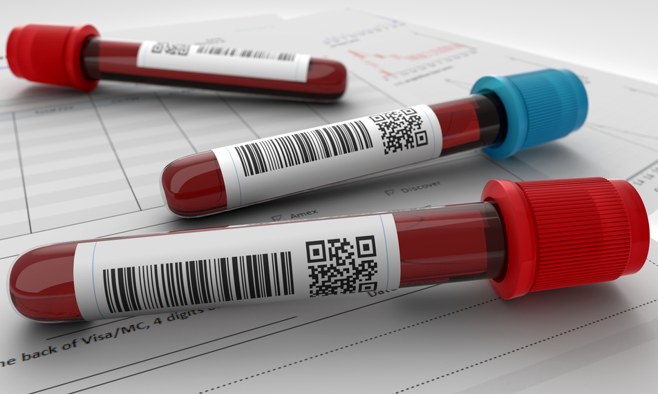 blood-test-to-detect-brain-metastases