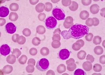 Genetic fault reduces the effectiveness of leukaemia treatment ...